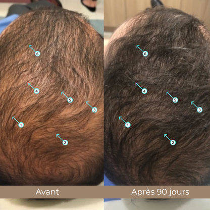 SPECTRAL - Lot de 3 mois